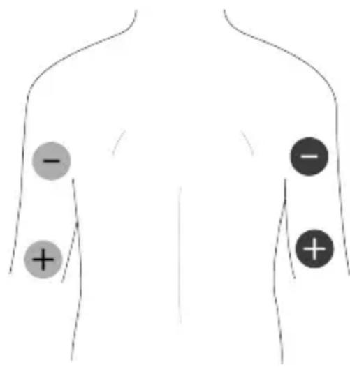 TensCare Unifit - Placement des électrodes EMS - 1