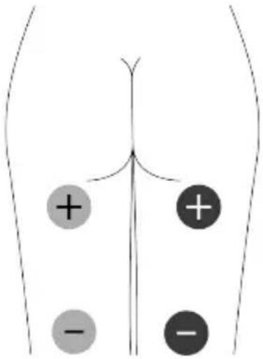 TensCare Unifit - EMC - 12