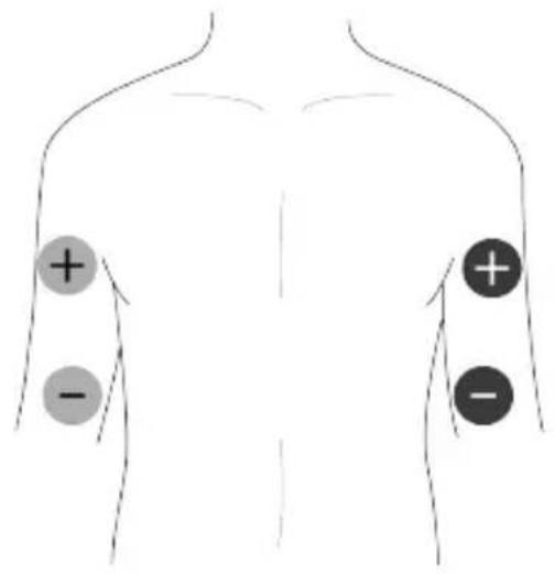 TensCare Unifit - EMS-Pad Platzierung - 2