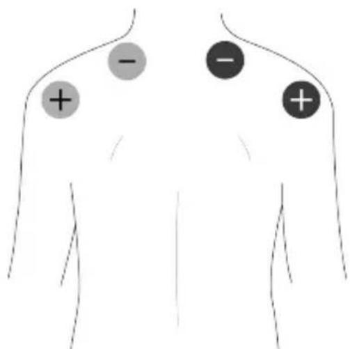 TensCare Unifit - Massage Pad Placement - 2