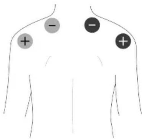 TensCare Unifit - EMC - 6