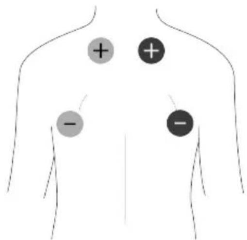 TensCare Unifit - Massage Pad Placement - 1