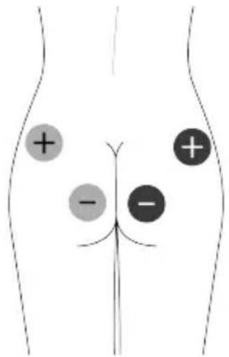 TensCare Unifit - EMC - 10