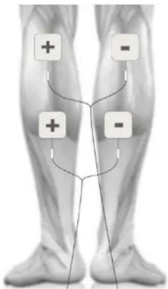TensCare Sports TENS 2 - PLACEMENT DES ÉLECTRODES DE MASSAGE - 2
