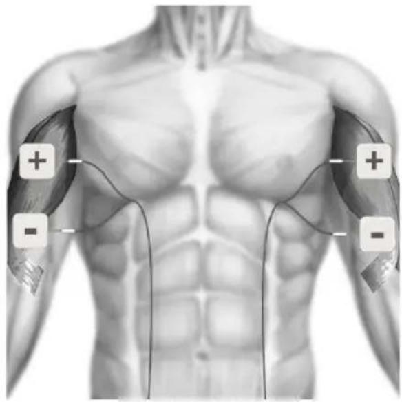 TensCare Sports TENS 2 - TENS ELECTRODE PLACEMENT - 2