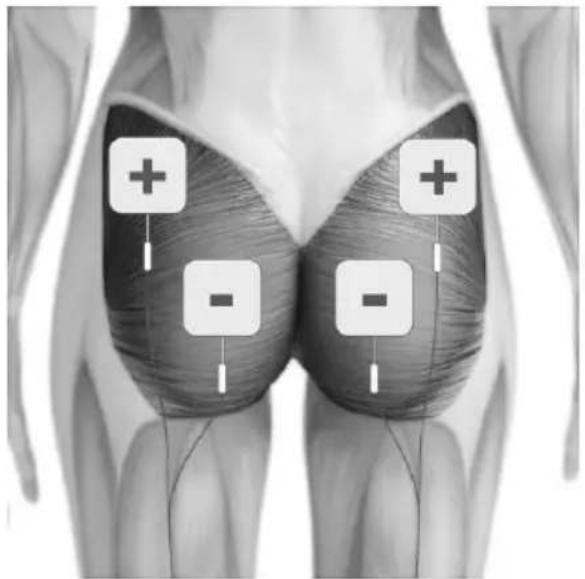TensCare Sports TENS 2 - EMS ELECTRODE PLACEMENT - 7