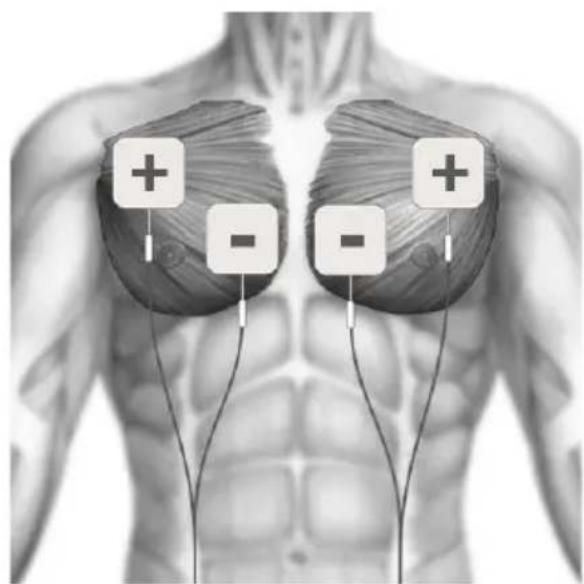 TensCare Sports TENS 2 - EMS ELECTRODE PLACEMENT - 2