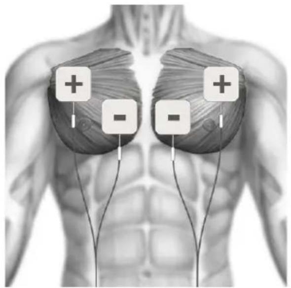 TensCare Sports TENS 2 - EMS POSICIÓN DE ELECTRODOS - 2