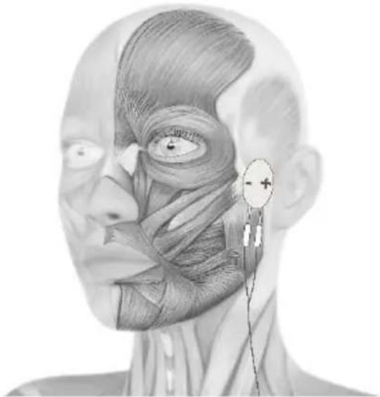 TensCare Sports TENS 2 - Gesichtsbehandlung mit optionalen Elektrodenpads - 4