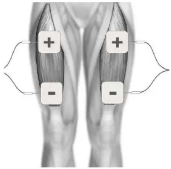 TensCare Sports TENS 2 - TENS ELECTRODE PLACEMENT - 9