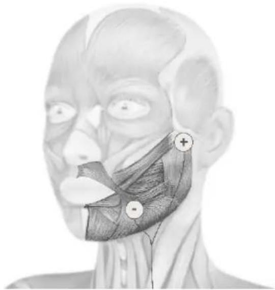 TensCare Sports TENS 2 - Face treatment with optional electrode pads - 3