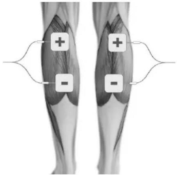 TensCare Sports TENS 2 - EMS ELECTRODE PLACEMENT - 9