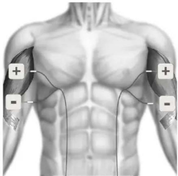 TensCare Sports TENS 2 - EMS ELECTRODE PLACEMENT - 4