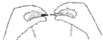 TensCare Sports TENS 2 - CONNECTING LEAD WIRES - 1