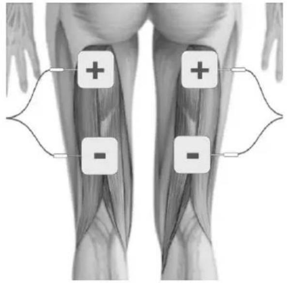 TensCare Sports TENS 2 - TENS ELECTRODE PLACEMENT - 7
