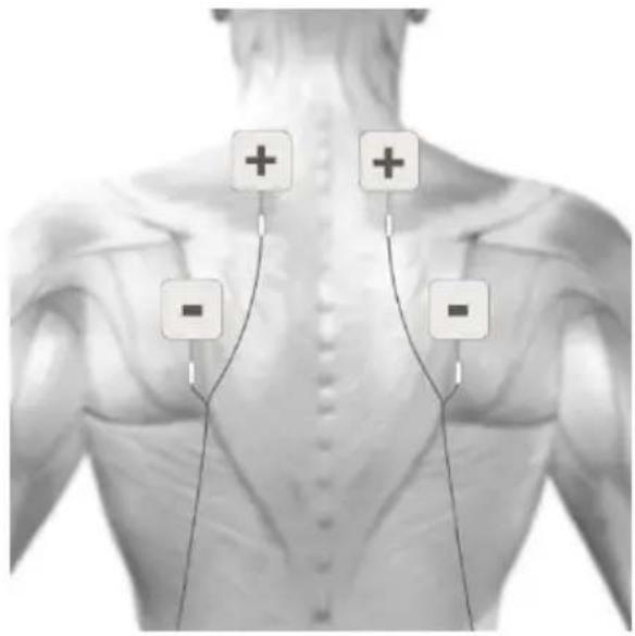 TensCare Sports TENS 2 - Gesichtsbehandlung mit optionalen Elektrodenpads - 5
