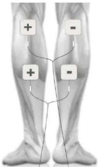 TensCare Sports TENS 2 - MASSAGE ELECTRODE PLACEMENT - 2