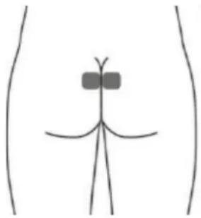 TensCare iTouch Sure - Electrodo para la piel opcional para URGE (Esto puede no ser tan efectivo como la estimulación con la sonda vaginal) - 1