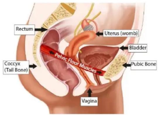 TensCare iTouch Sure - PELVIC FLOOR MUSCLES - 1