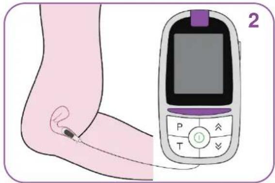 TensCare iTouch Sure - 3