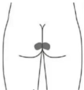 TensCare iTouch Sure - Electrodo para la piel opcional para STRESS (Esto puede no ser tan efectivo como la estimulación con la sonda vaginal) - 3
