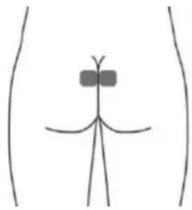TensCare Unicare - Optionale Elektroden für STRESS (dies ist möglicherweise nicht so effektiv wie die Stimulation mit der Vaginalsonde). - 1