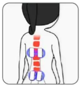 TensCare Unicare - Pain Gate - 1