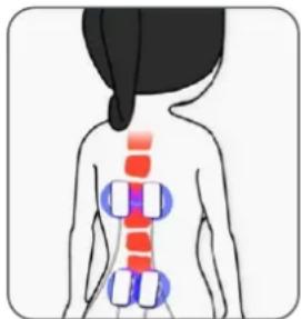 TensCare TENS One - Dolor Consistente - 1