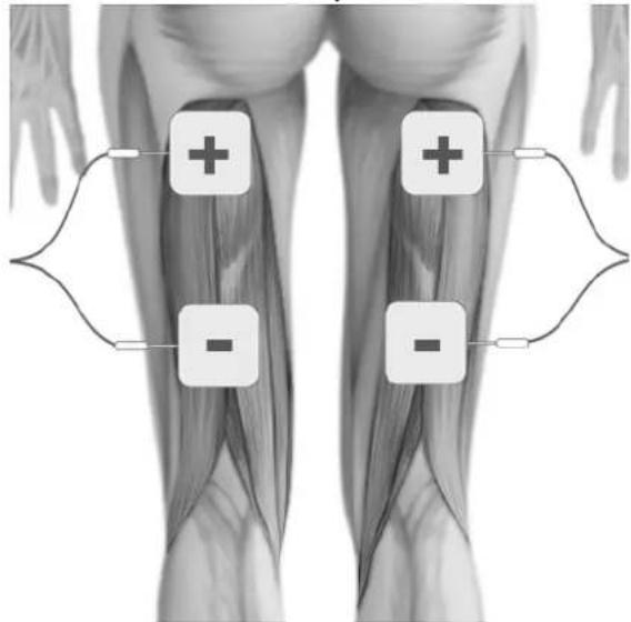 TensCare Allura - ELECTRODE PLACEMENT - 7