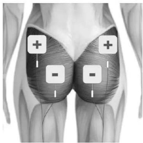 TensCare Eva - POSITIONNEMENT DES ELECTRODES - 6