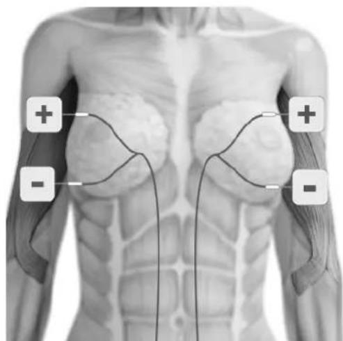 TensCare Eva - ELECTRODE PLACEMENT - 15