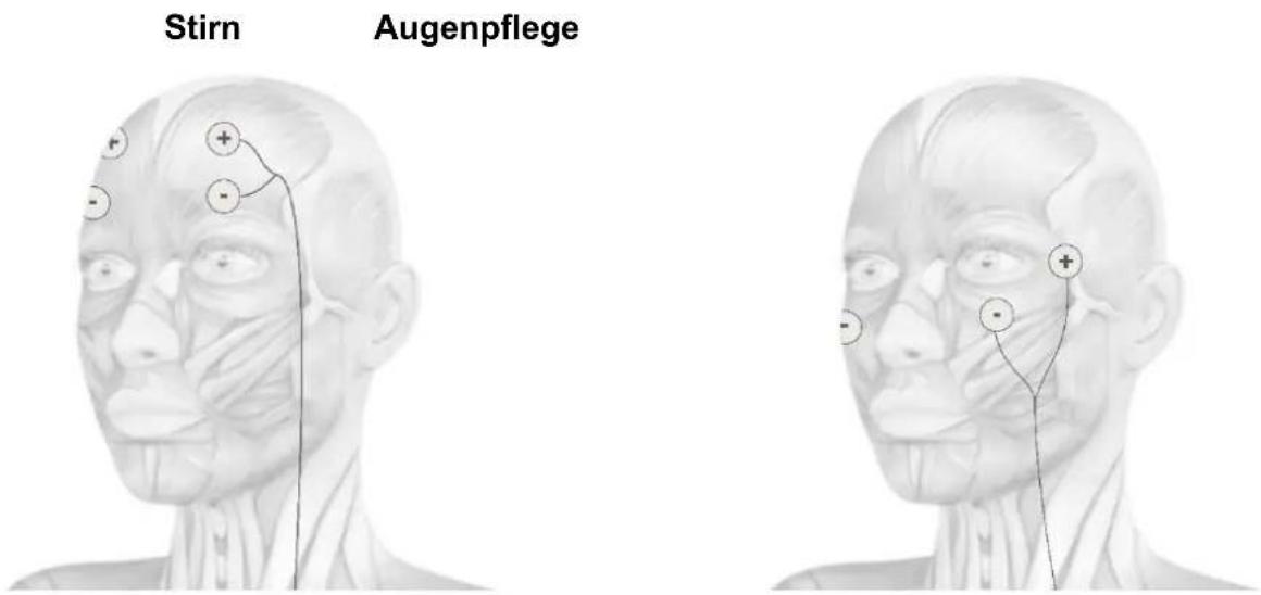TensCare Eva - ELEKTRODEN PLAZIERUNG - 3