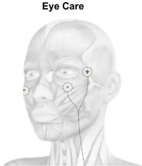 TensCare Eva - ELECTRODE PLACEMENT - 5