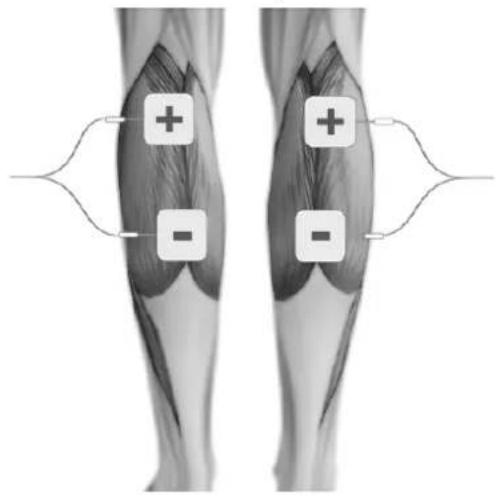 TensCare Eva - ELECTRODE PLACEMENT - 16