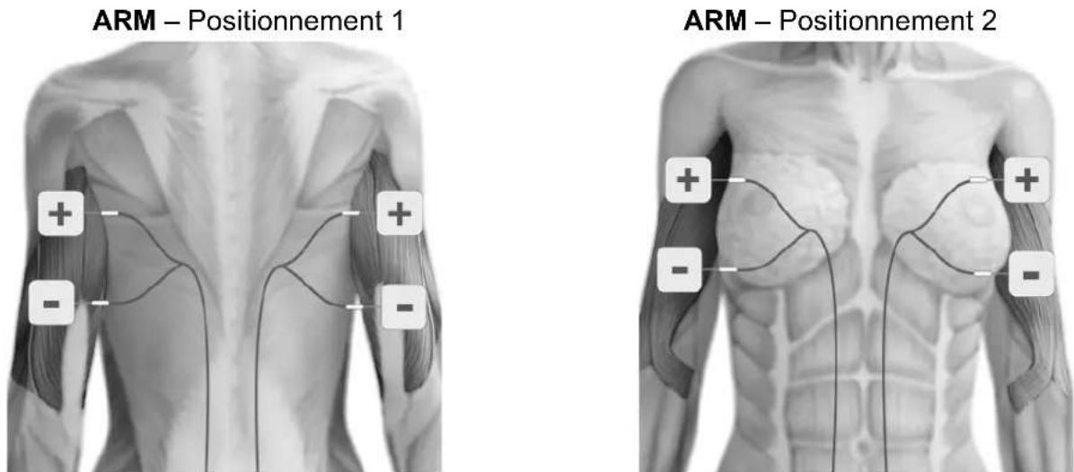 TensCare Eva - POSITIONNEMENT DES ELECTRODES - 9