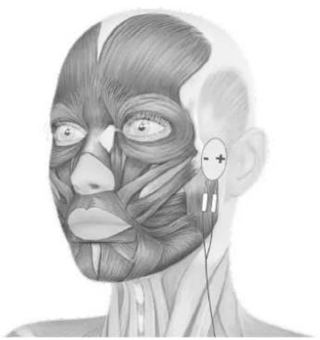TensCare Eva - ELECTRODE PLACEMENT - 2