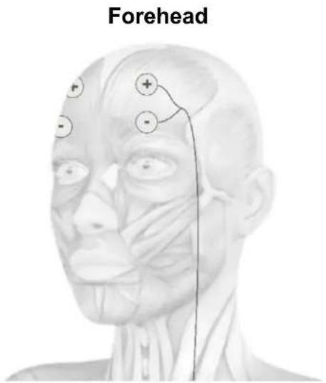 TensCare Eva - ELECTRODE PLACEMENT - 4