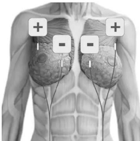 TensCare Eva - POSITIONNEMENT DES ELECTRODES - 8