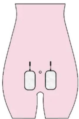TensCare Alivia - Por favor consulte los diagramas: - 2