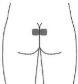 TensCare Alivia - Optionale Elektroden für DRANG (URGE) (dies ist möglicherweise nicht so effektiv wie die Stimulation mit der Vaginalsonde). - 2