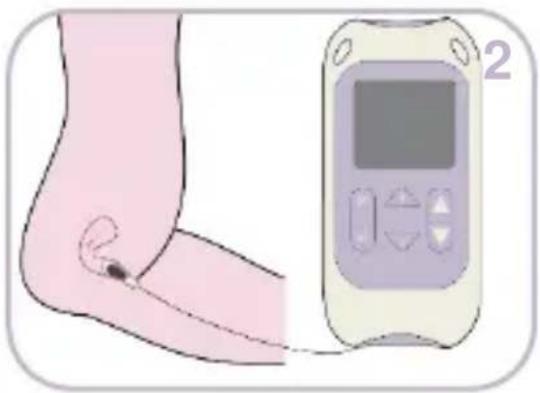 TensCare Kegel Toner - 1