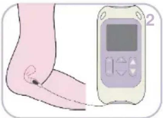 TensCare Kegel Toner - SCHNELLSTARTANLEITUNG - 2