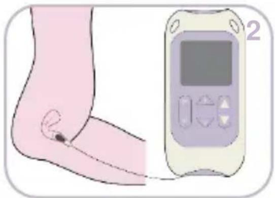 TensCare Kegel Toner - 1