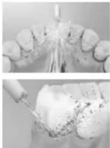PANASONIC EW-DJ26 - Periodontal cep temizliği - 1