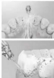 PANASONIC EW-DJ67 - Periodontal cep temizliği - 1
