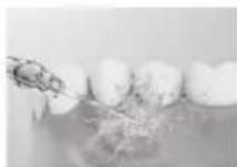 PANASONIC EW-DJ67 - Periodontal cep temizliği - 2