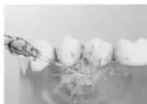 PANASONIC EW-DJ67 - Gums care - 2