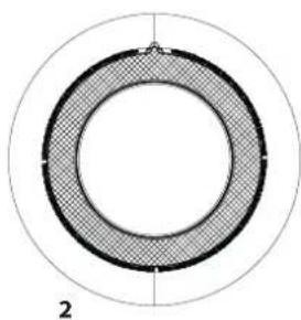 WHIRLPOOL FFTN M22 9X2 EU - Opcijske tipke\* - 1
