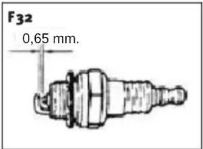 Anova MG2600 - Amortisseur frontal et postérieur - 3