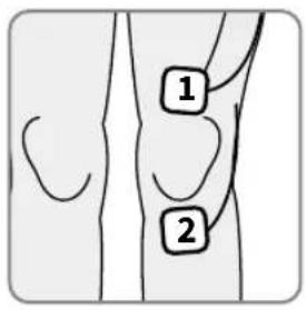 REVITIVE Medic Knee 5574AQ - Platzierung der kleinen Elektroden-Pads zur Schmerzlingerung - TENS-Modus - 1